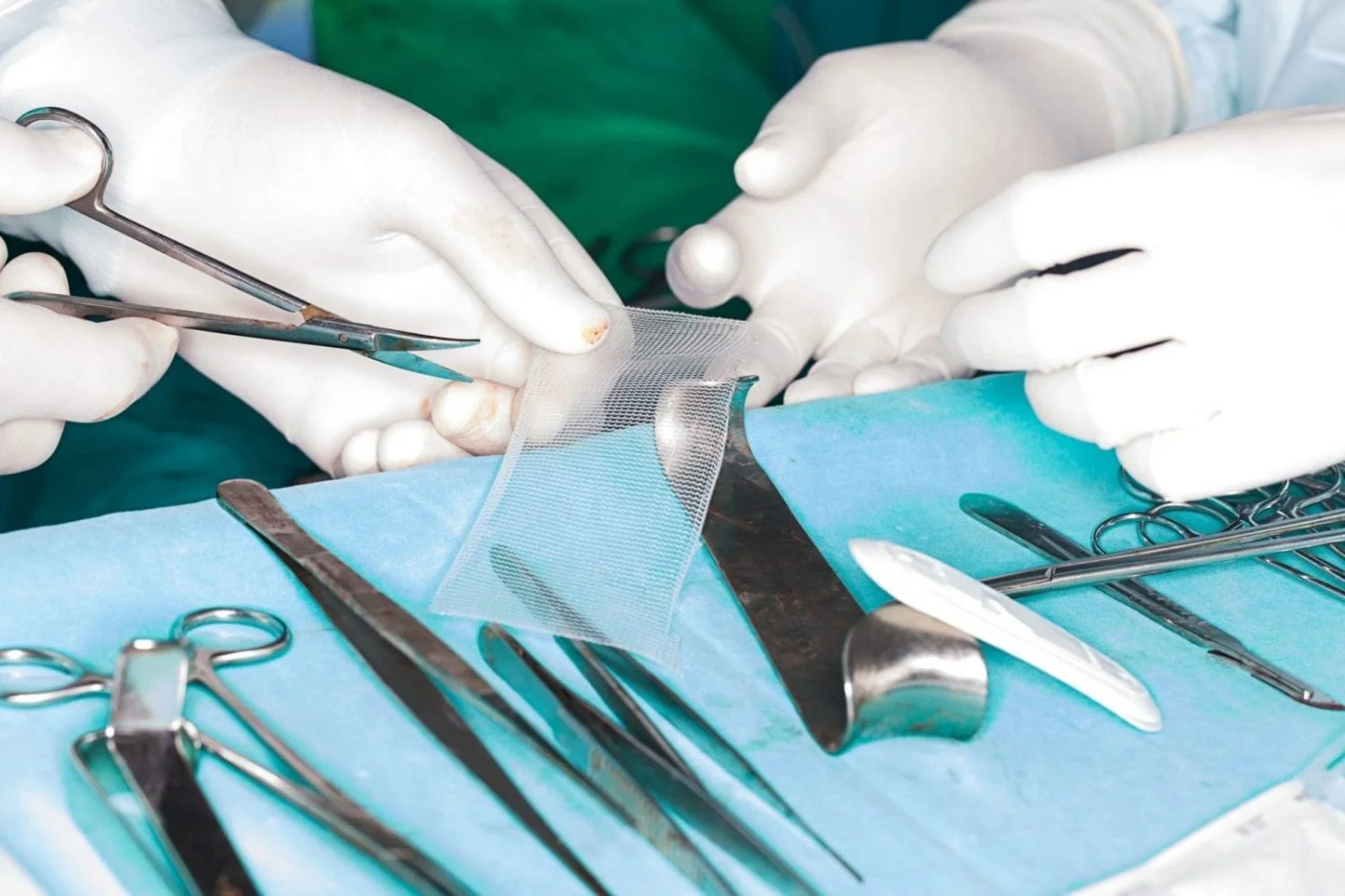 Surgeons Performing A Hernia Mesh Procedure Stock Photo